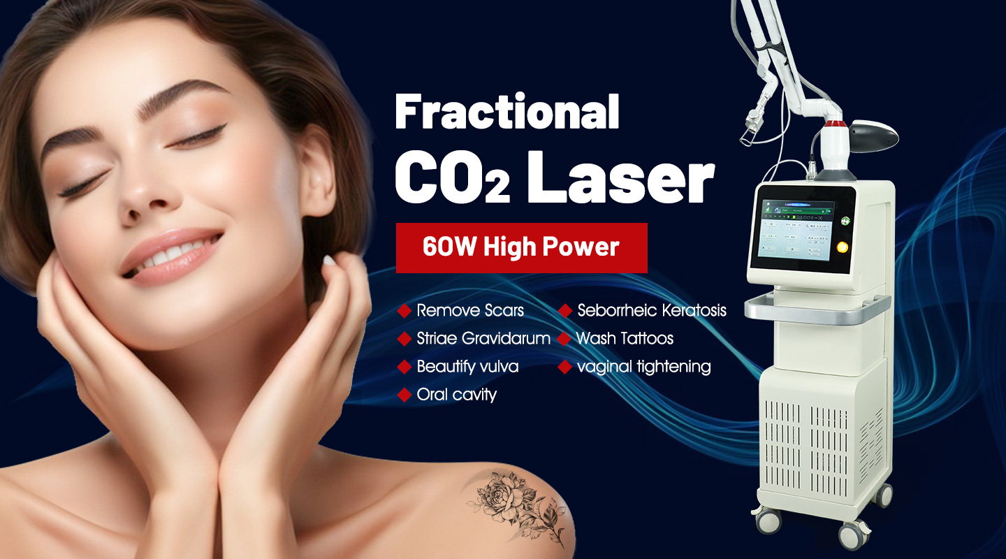 CO2 laser