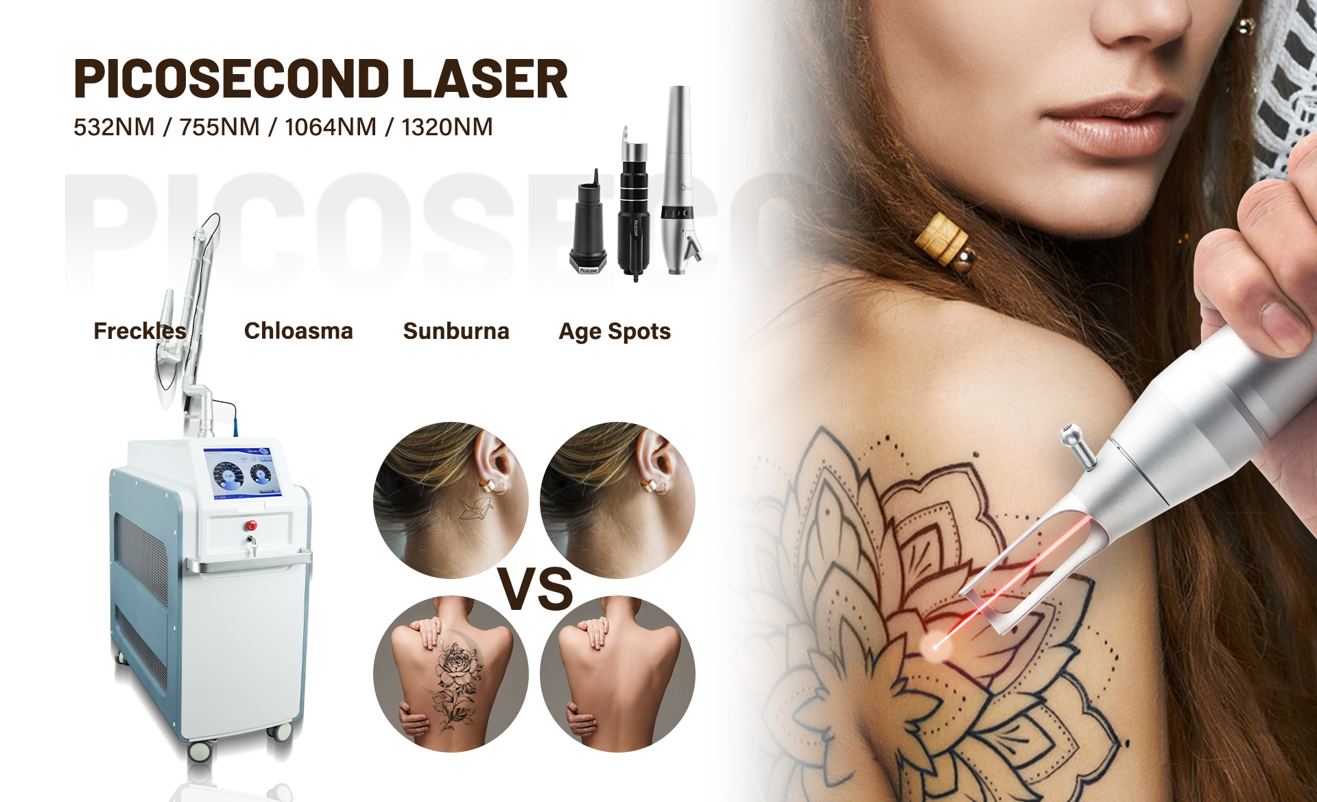 Picosecond laser for tattoo removal